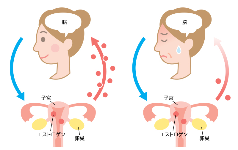 更年期障害はなぜ起こるのか 原因やいろいろな不調がでる理由 基礎知識 いきいき更年期